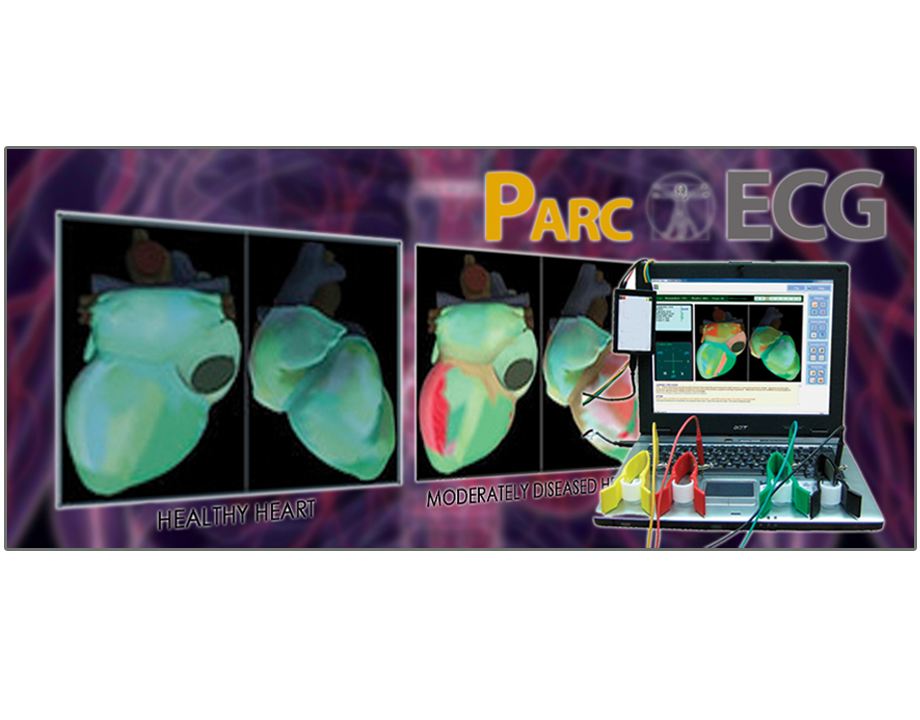 PARC Cardio Screening Device - #PreventHeartDiseaseToday